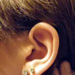 Orecchie a sventola, addio per sempre: ecco l’intervento che risolve in modo definitivo l’inestetismo