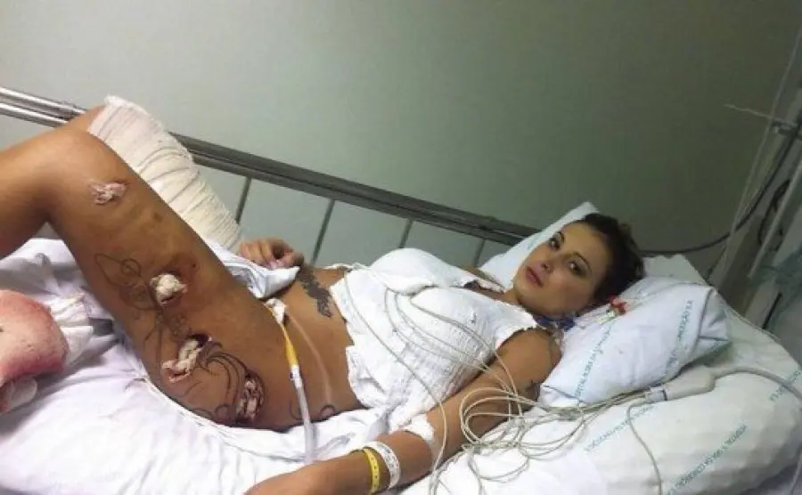 Vietato in Italia da vari anni il prodotto usato da Andressa Urach