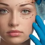 Blefaroeasy: ringiovanire lo sguardo senza bisturi