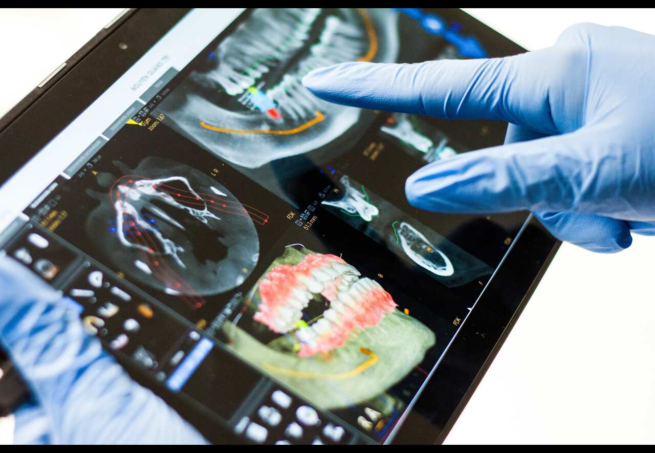 Chirurgia dentale: ecco in cosa consiste e quando si attua
