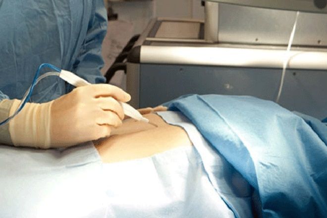 Gemellaggio tra l'Associazione italiana di chirurgia plastica estetica (Aicpe) e la "sorella" americana 