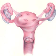 Diventa mamma dopo cinque anni di tentativi. Nonostante l'endometriosi