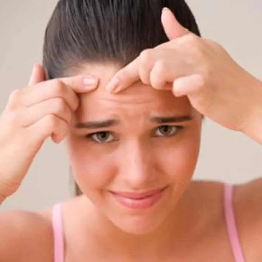 Acne: cosa fare per liberarsene?