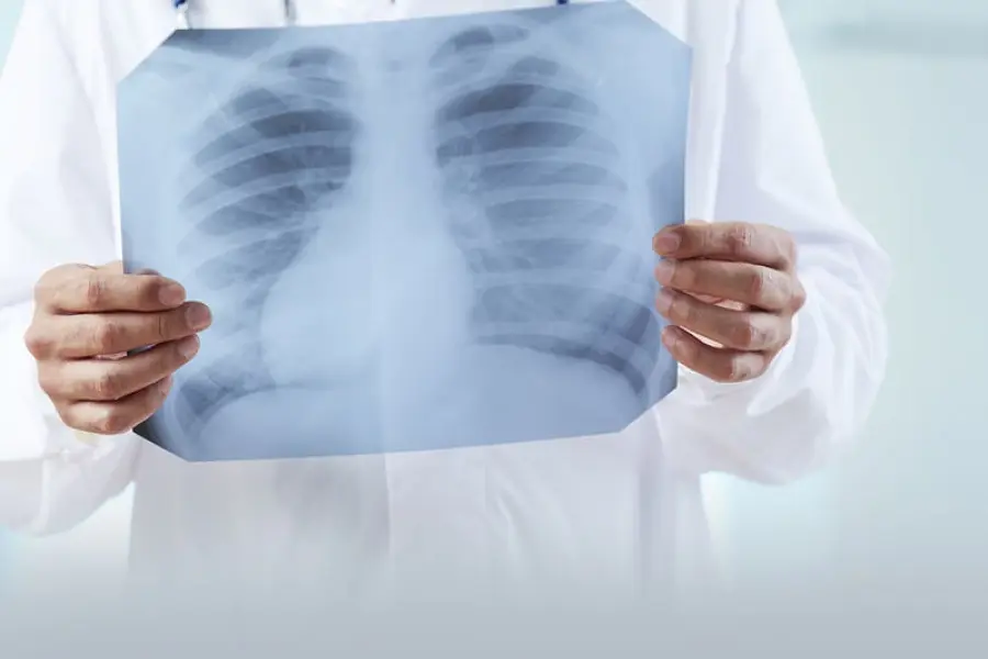 Radiografie ed ecografie: come farle a domicilio a Milano in sicurezza