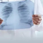 Radiografie ed ecografie: come farle a domicilio a Milano in sicurezza