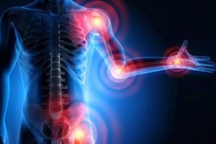 Artrosi: cause e fattori di rischio