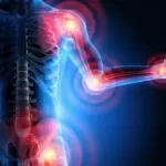 Artrosi: cause e fattori di rischio