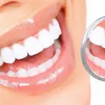 Come avviene lo sbiancamento dei denti