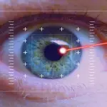 Chirurgia cataratta: approfondimenti e novità