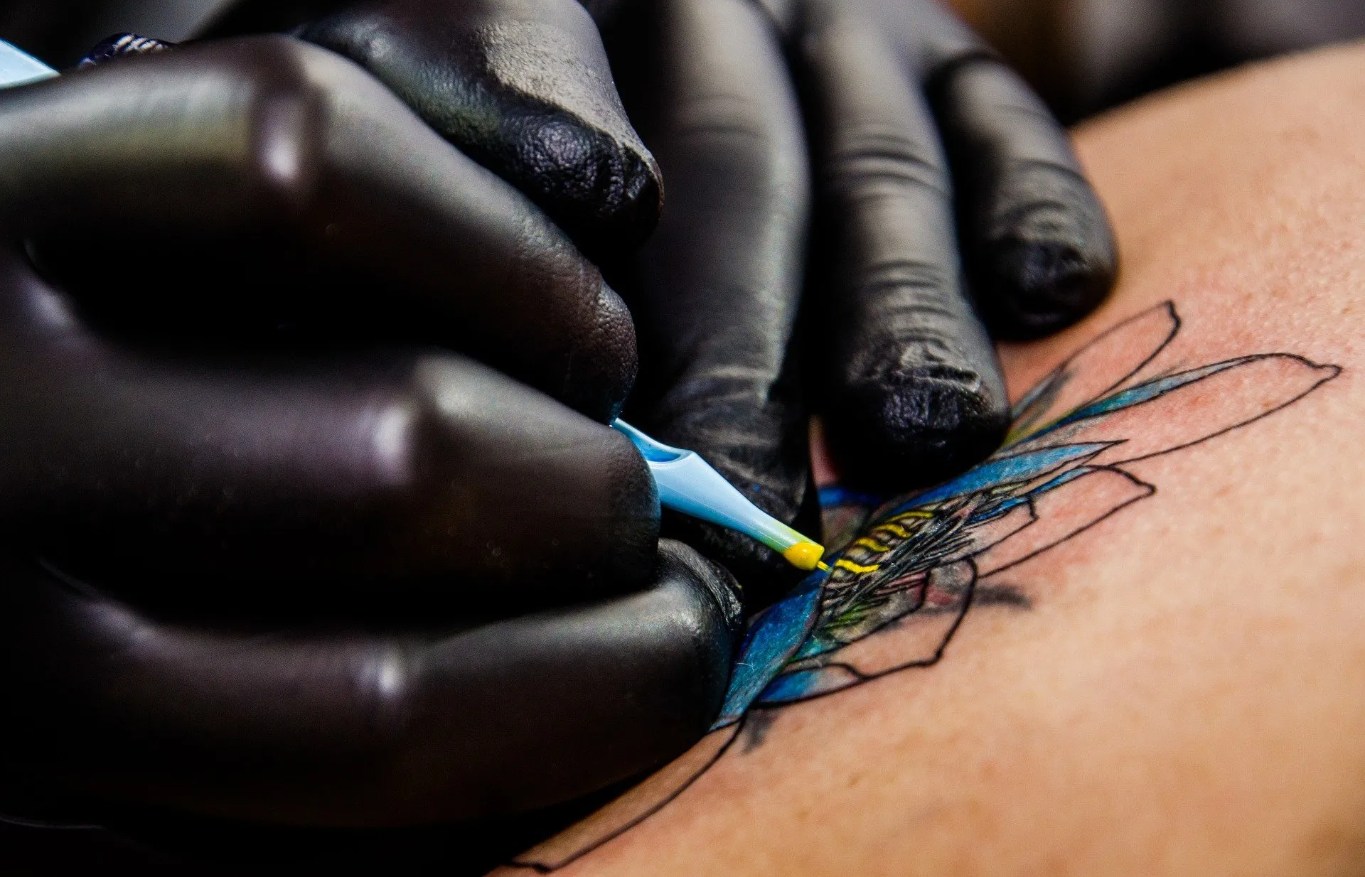 Un tatuaggio non è per sempre: le dieci cose (più una) da sapere prima di rimuovere un tattoo