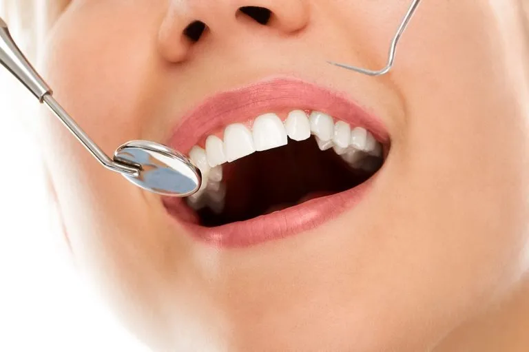 Cos’è e come funziona l’implantologia dentale